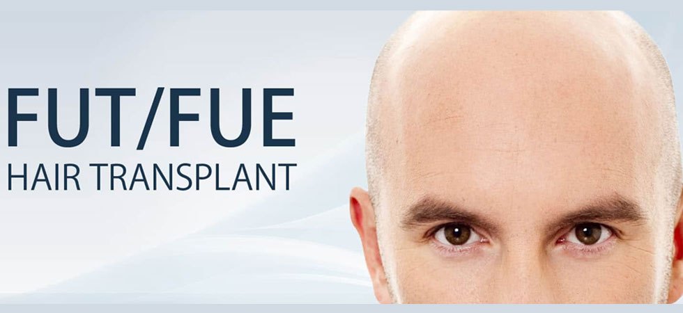  Best hair loss treat ment in bangalore- Hair loss treatment - Hair fall treatment - hair doctor near me - gfc treatment for hair