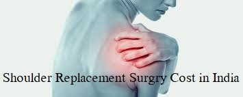 Shoulder Replacement Surgery Cost in India