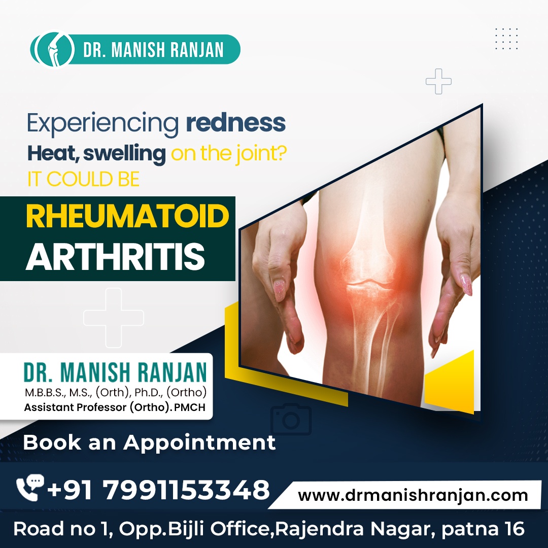 Best Rheumatoid Arthritis in Patna