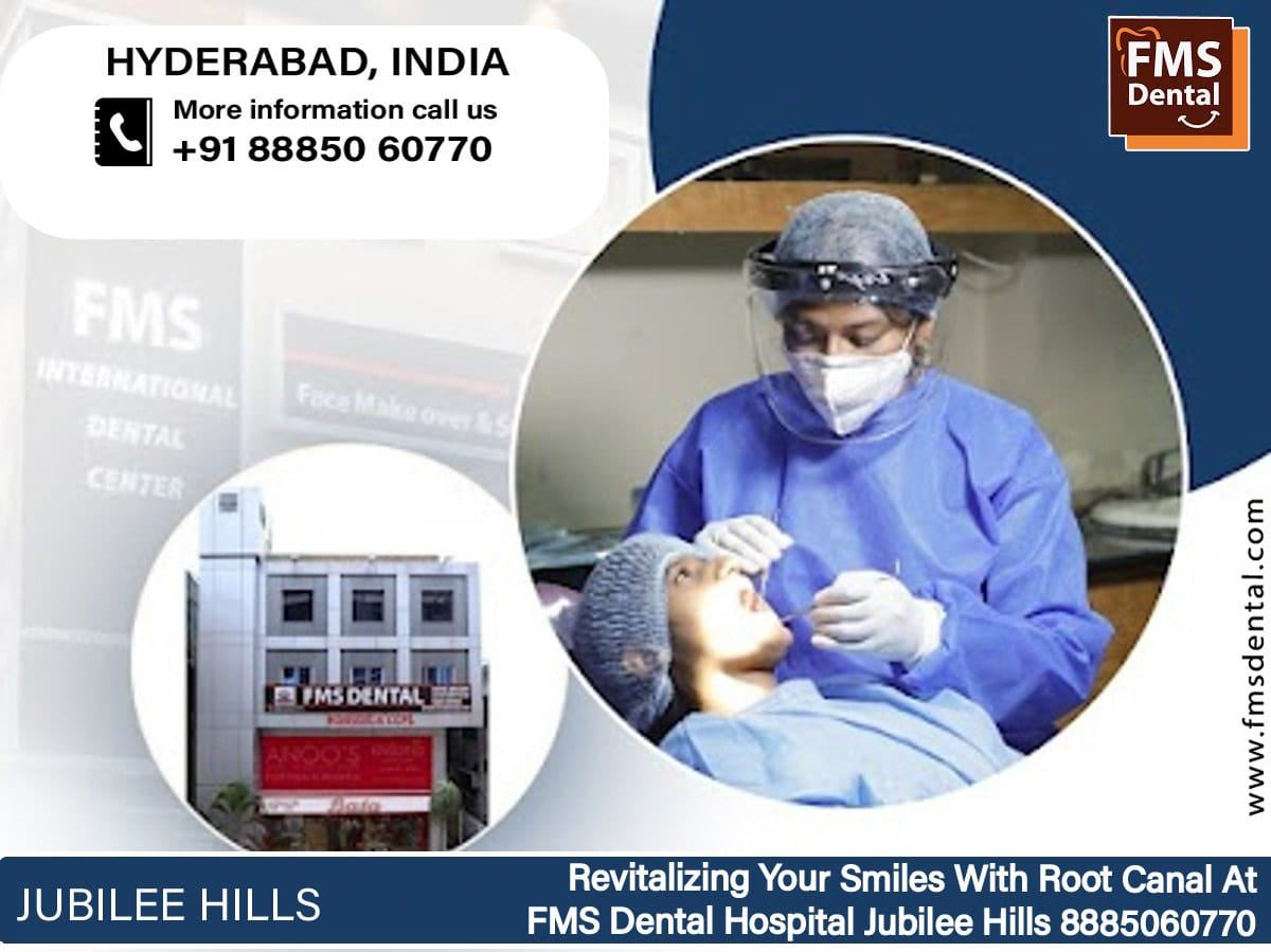 Revitalizing Your Smiles With Root Canal at FMS Dental Hospital Jubilee Hills 8885060770