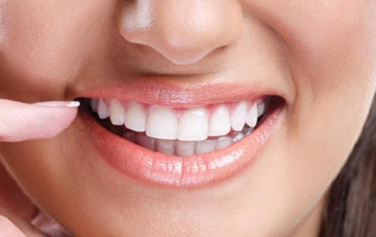 Smile Makeover Treatment Ahmedabad | 9825158578